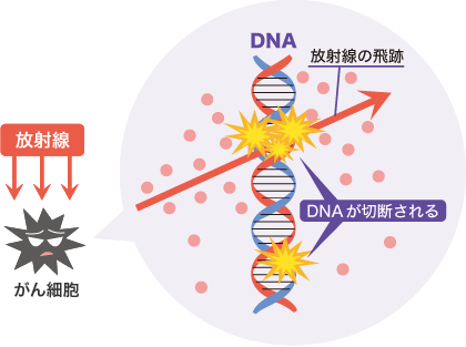 放射線によるダメージのイメージ図