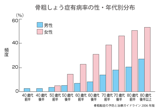 骨粗鬆症念だグラフ
