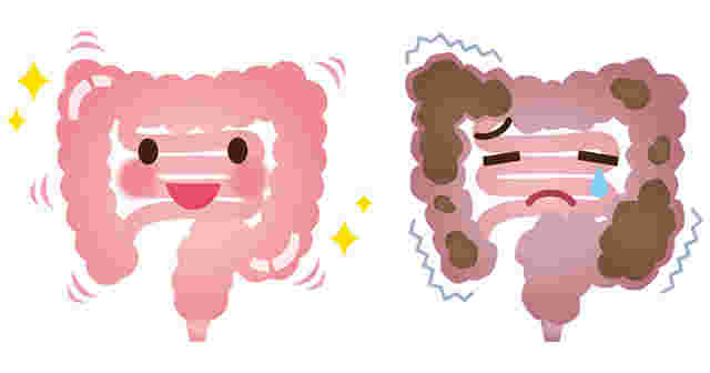 便秘気味の腸と便秘解消された腸のイラスト