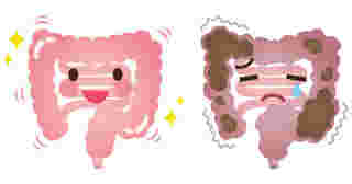 健康で正常な腸と便秘がちになっている不健康な腸