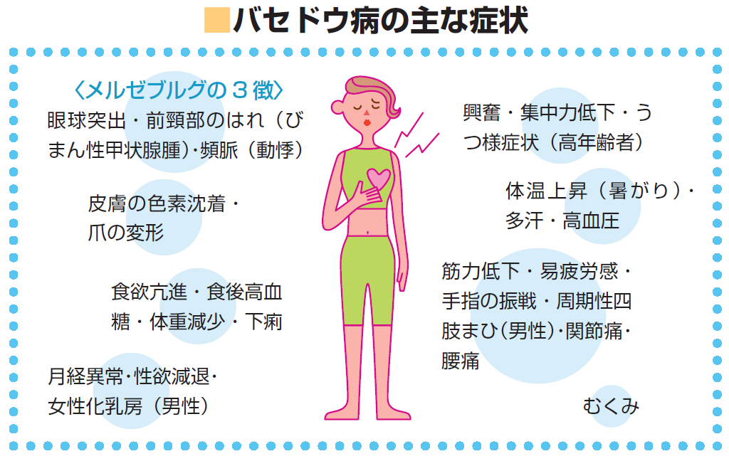 バセドウ病症状の画像