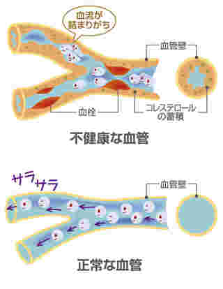 コレステロール低下に伴う血管の改善