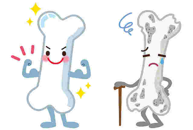 丈夫な骨ともろくなった骨のイラスト