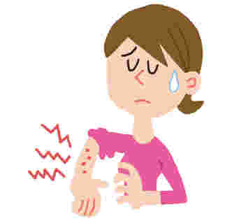 かゆみの症状が出ている女性のイラスト