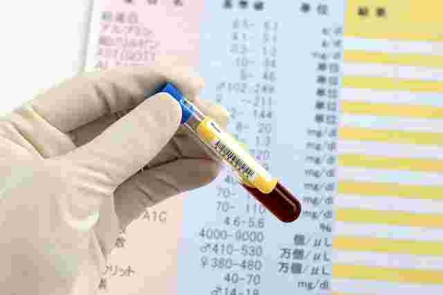 健康診断表と血液検査の画像