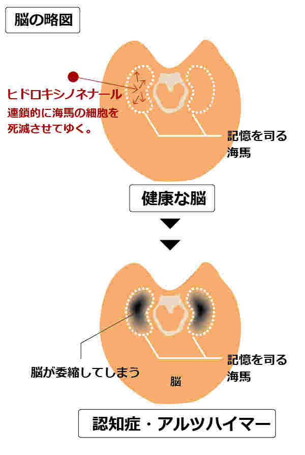 ヒドロキシノネナールが海馬に影響を及ぼすことを示したイラスト