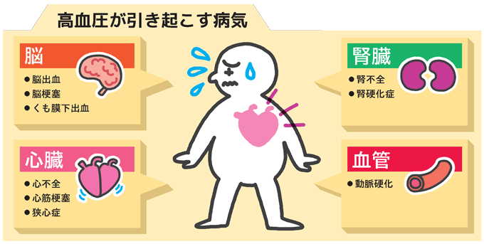 高血圧がもたらす病気のイラスト