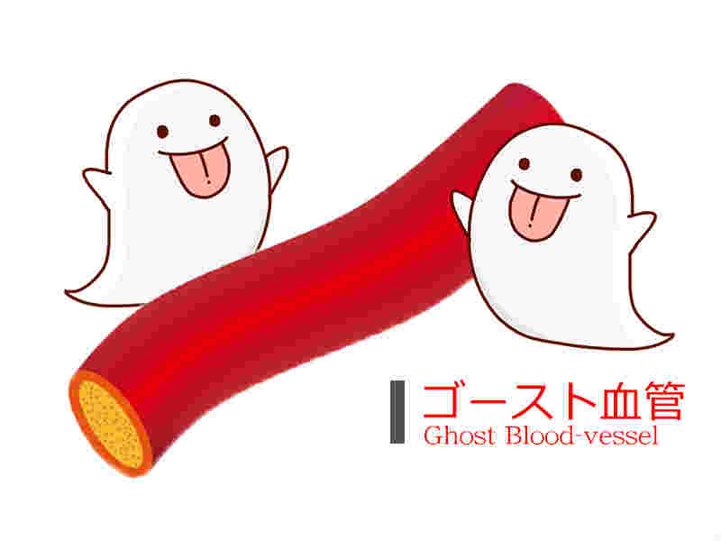 ゴースト血管の文字とお化けと血管のイラスト