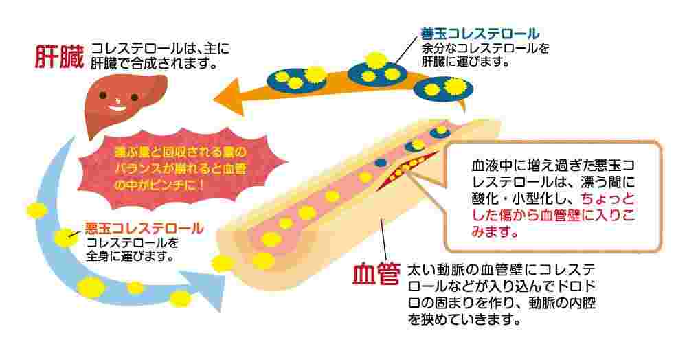 肝臓と血管でのコレステロールの状態のイラスト