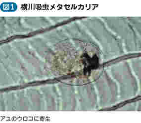 有害異形吸虫