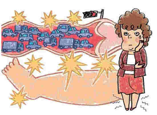 足のむくみを表現するイラスト