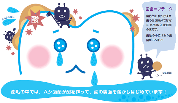 歯と虫歯菌、歯垢の関係図