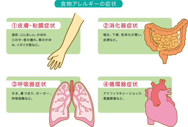 アレルギーの症状で現れる疾患