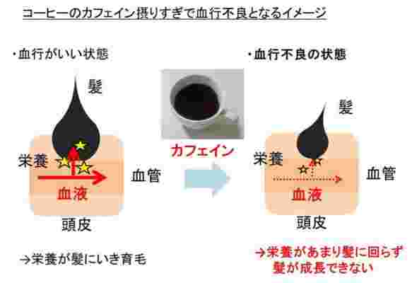 コーヒーが原因で血行不良になるイメージイラスト